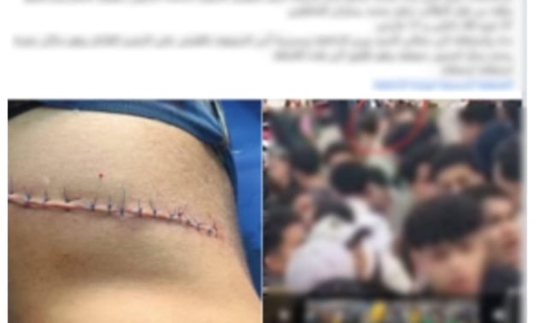 الواقعة
