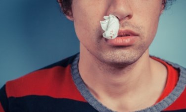 خروج دم من الأنف 