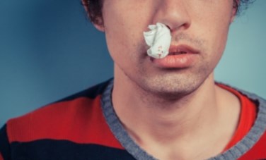 خروج دم من الأنف 