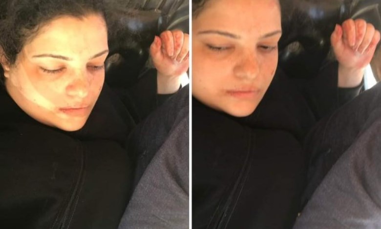 صورة أحدي الضحيتين