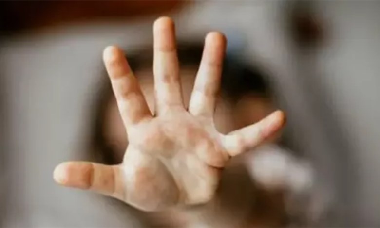 صورة تعبيرية