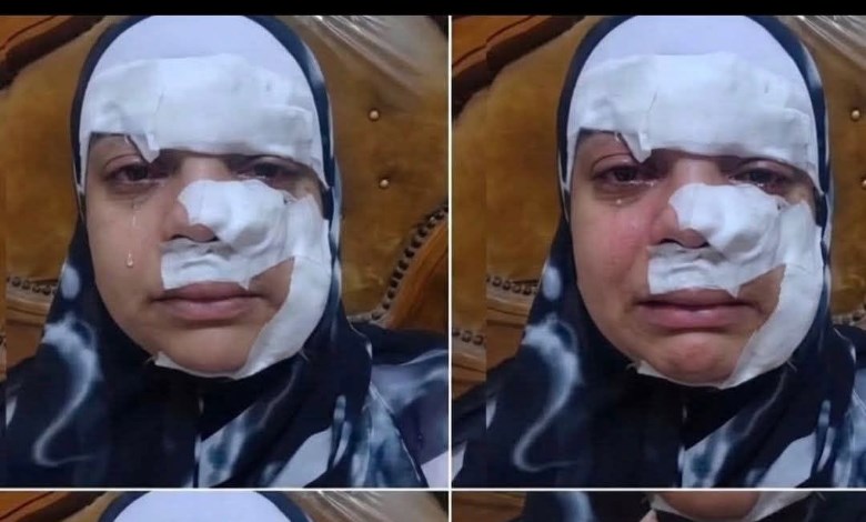 الضحية